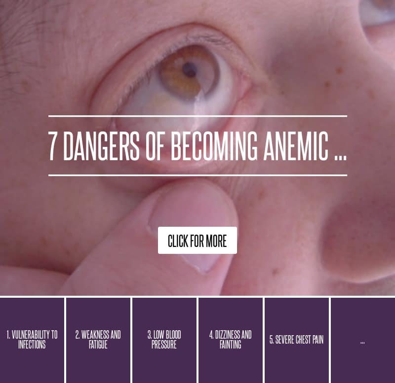 7 Dangers of Becoming Anemic ... Health