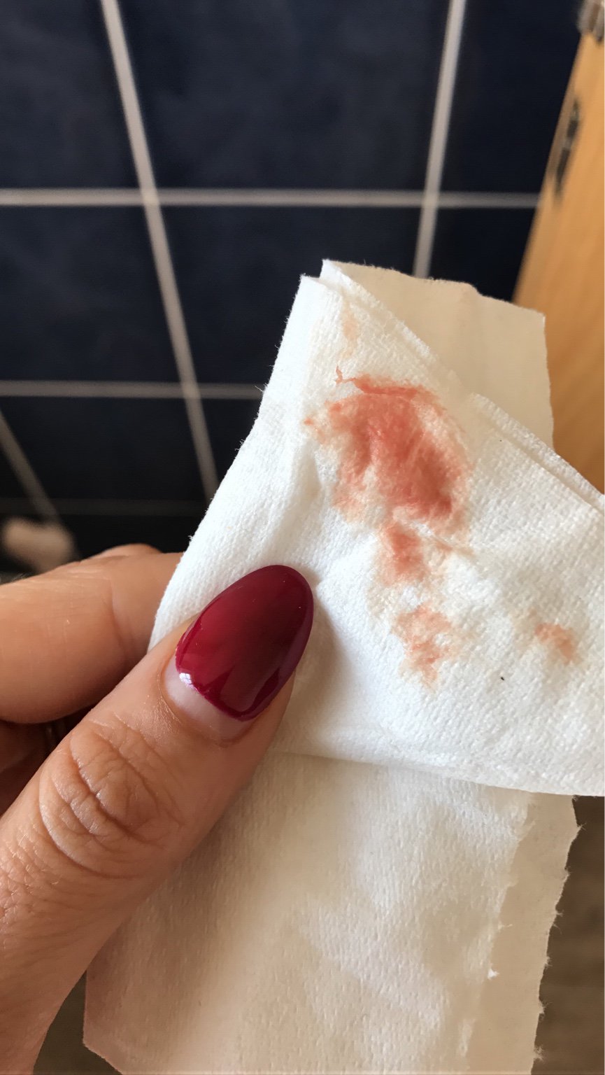 7 weeks bleeding/spotting help!