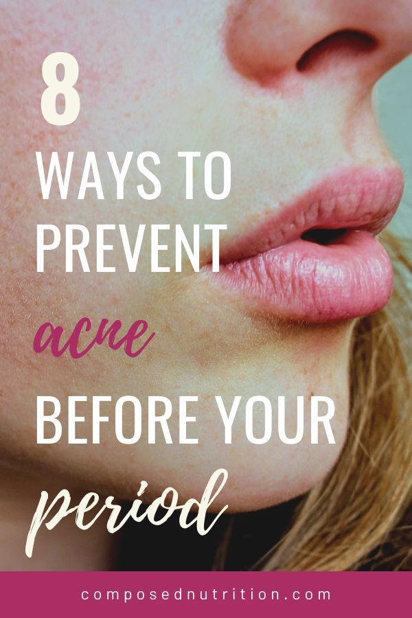 Acne Before Period: 8 Ways to Prevent  Composed Nutrition ...