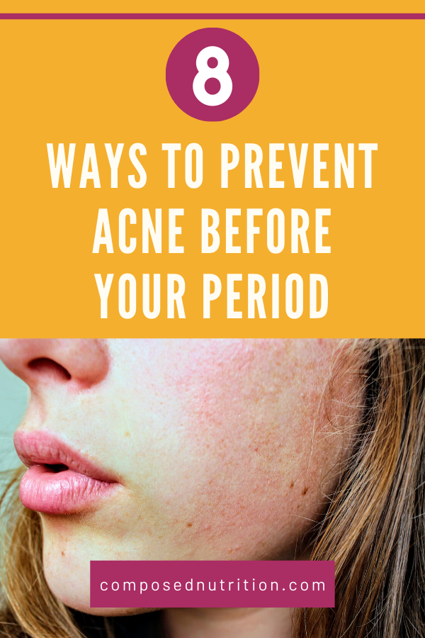 How To Prevent Acne Before Period Naturally - PeriodProHelp.com