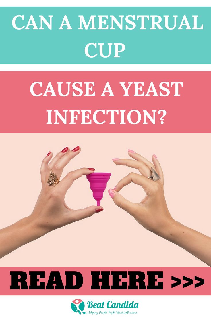 Can menstrual cup cause a yeast infection? Find out about ...