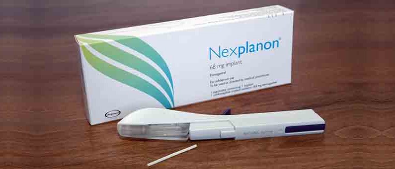 Can You Get Pregnant on The Implant (Nexplanon ...