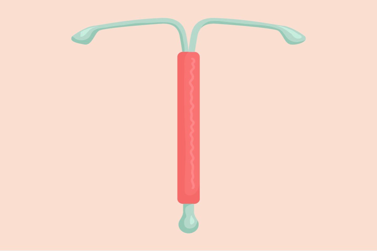 Five Questions to Ask Your Doctor Before Getting an IUD