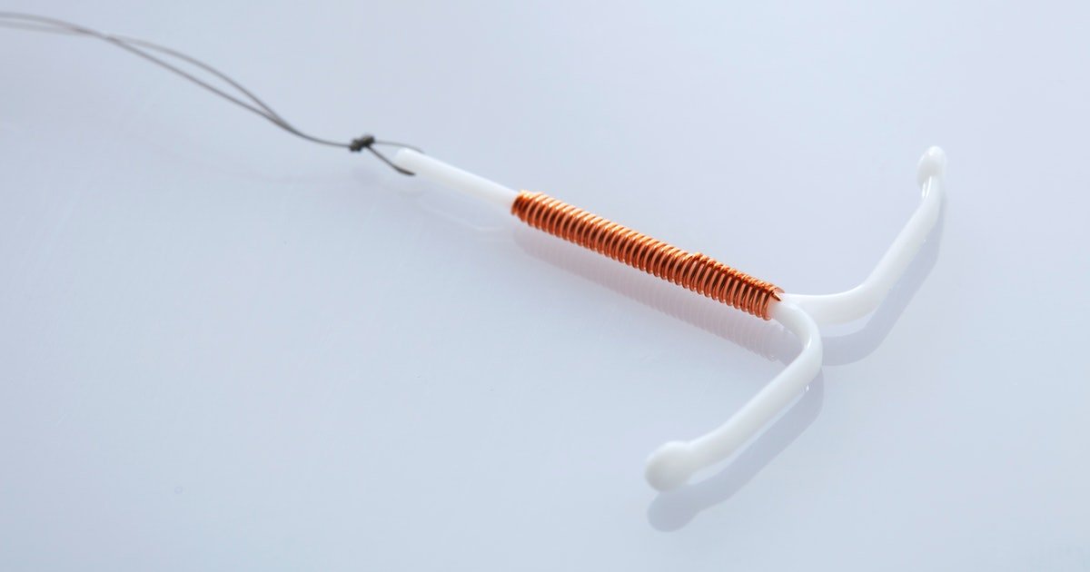 Getting Your IUD Replaced? Heres What Doctors Want You To ...