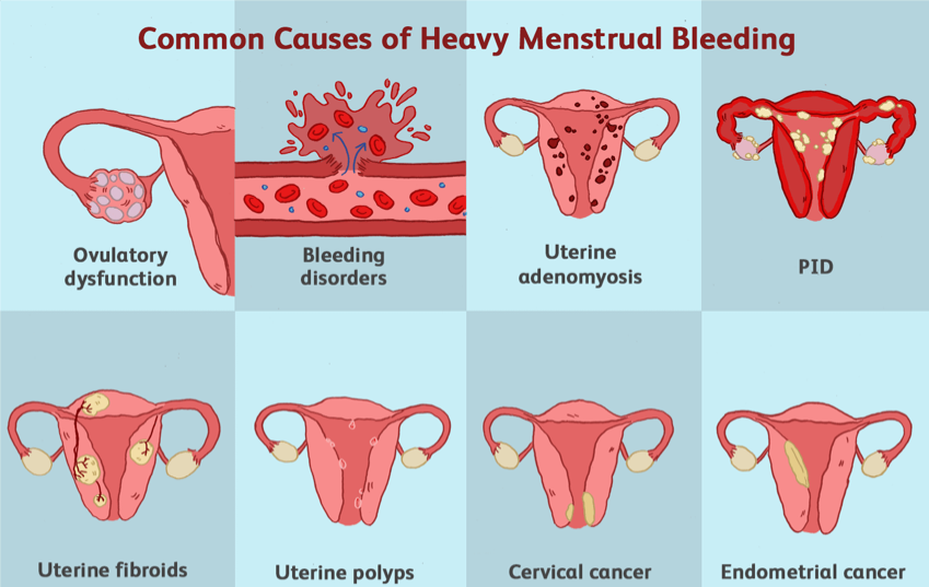 Heavy Periods