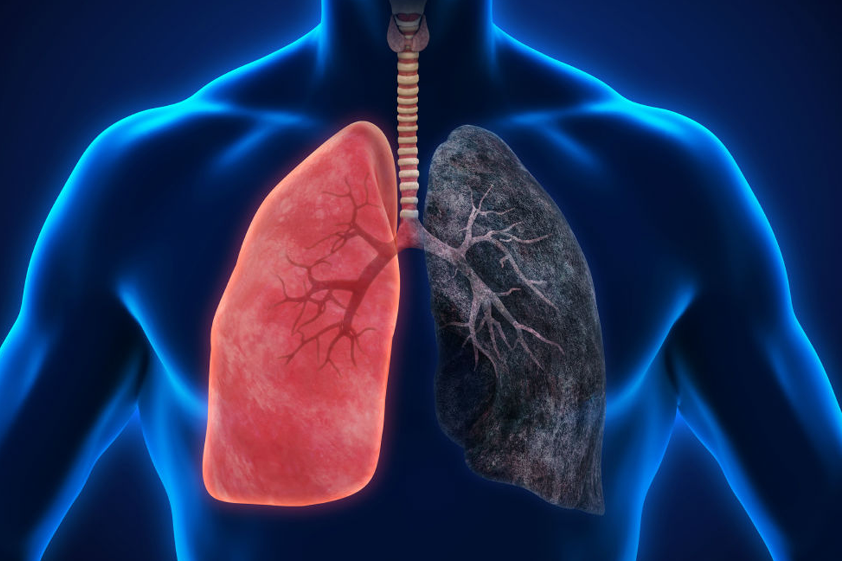 Hereâs how cigarette smoking can affect your lungs