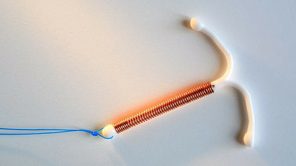 Heres Everything You Need To Know Before Getting An IUD ...