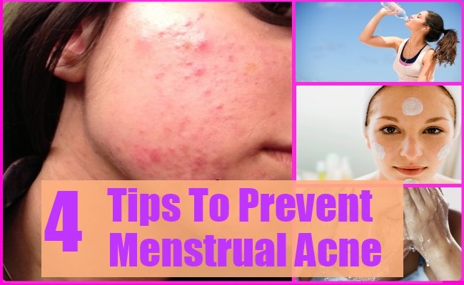 How To Prevent Menstrual Acne
