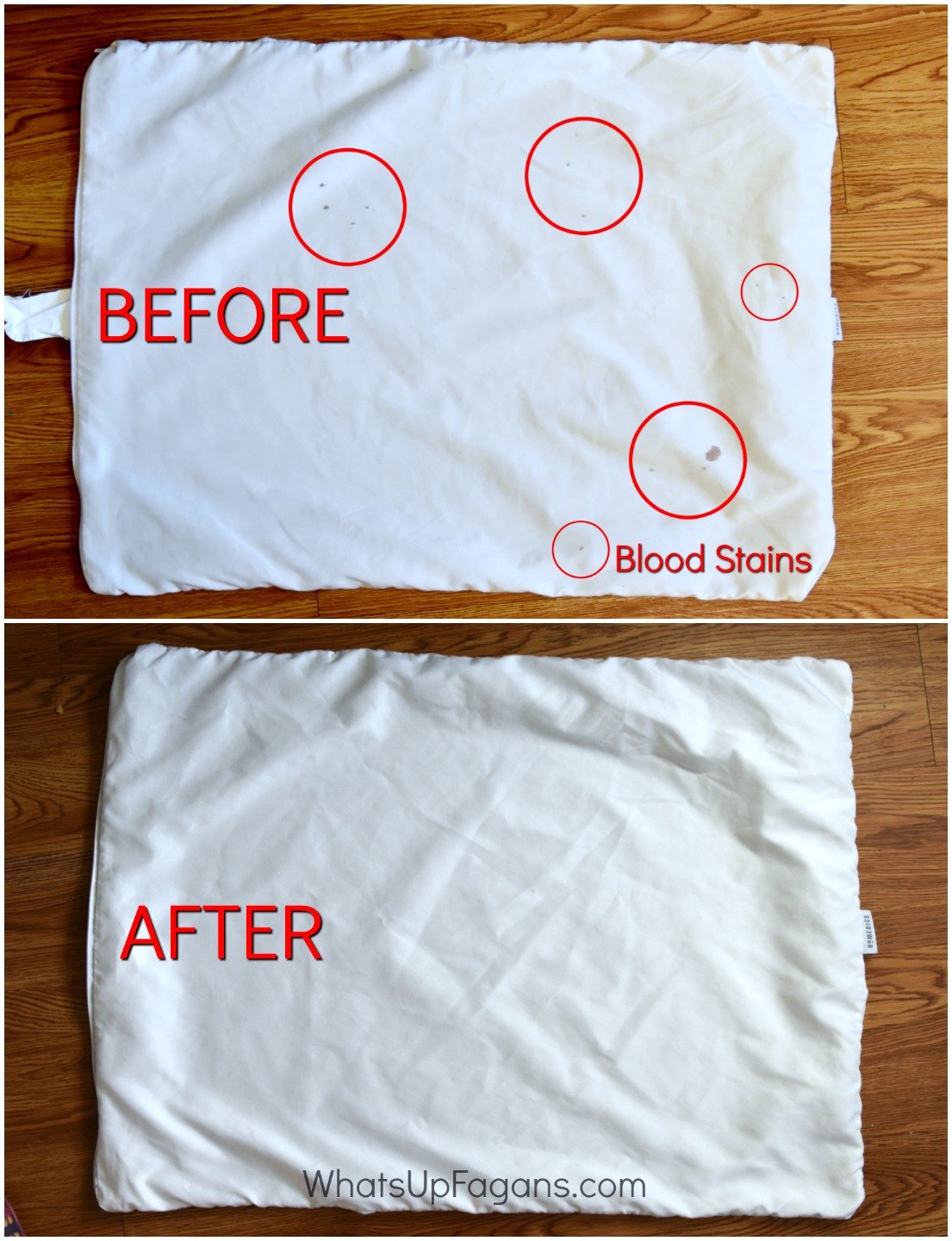 How to Remove Dried Set In Blood Stains from Clothes