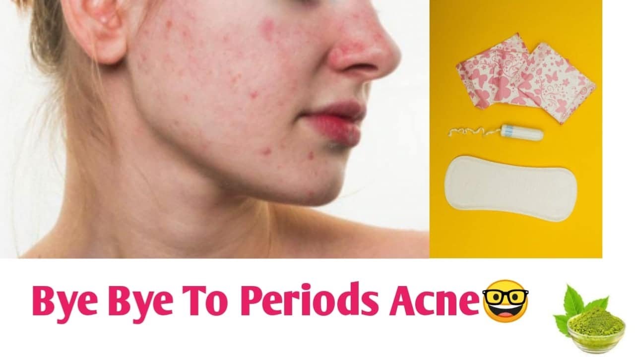 How To Stop Acne Breakouts During PERIODS
