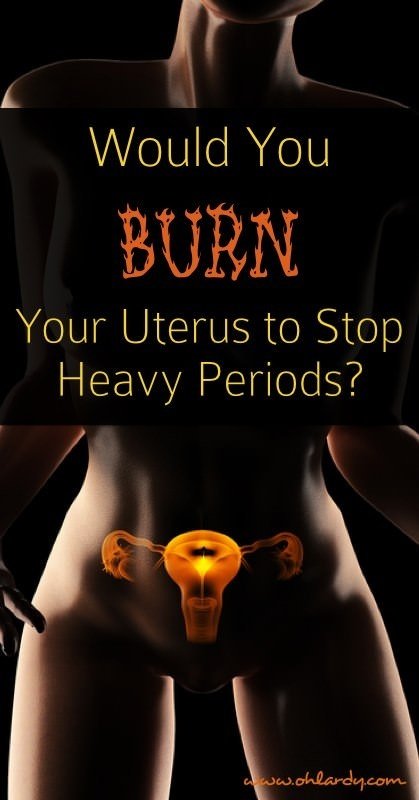 How to stop menstrual periods permanently