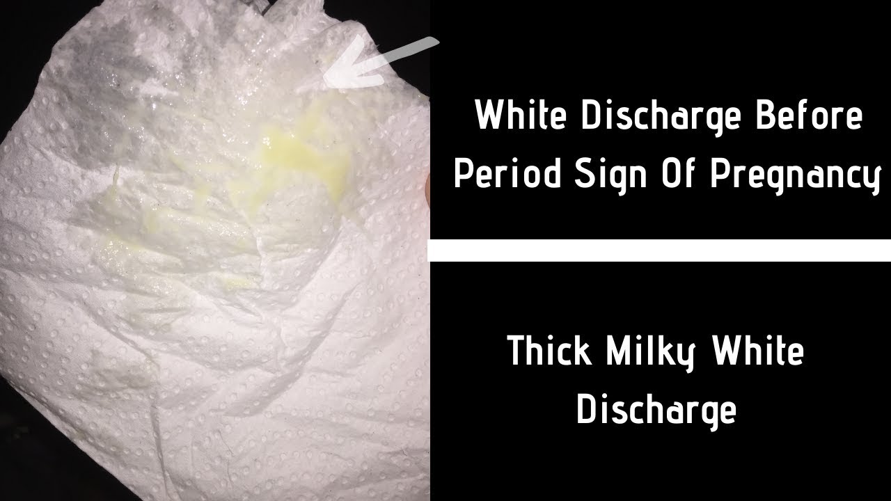 White Discharge Before Period Sign Of Pregnancy - PeriodProHelp.com