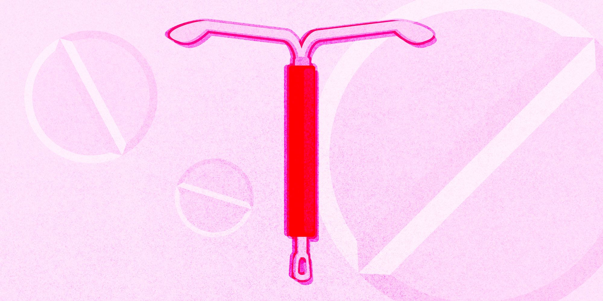 Iud insertion sex. IUD Insertion: A Positive Personal Experience, Side ...