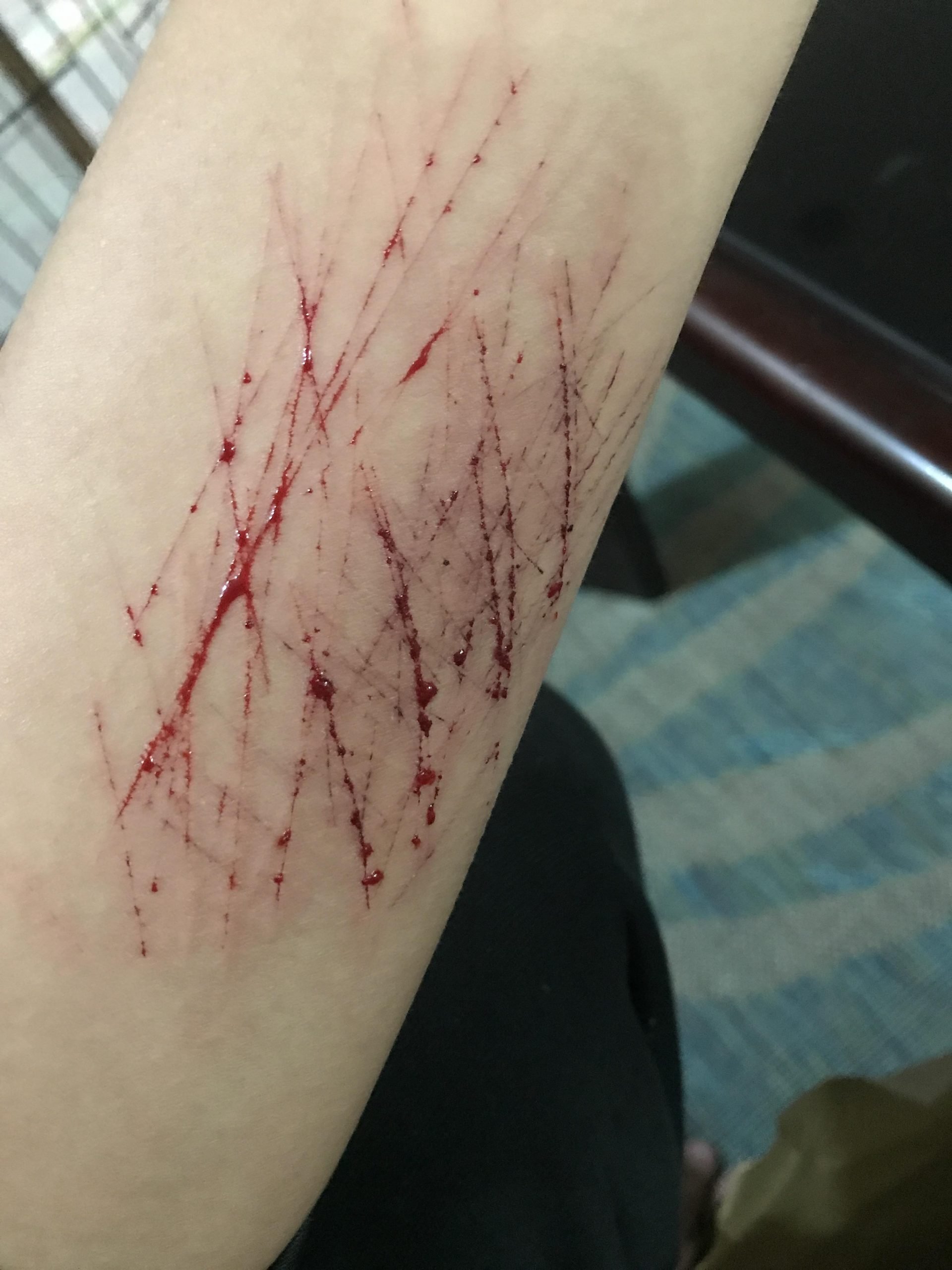 Ive been cutting myself to avoid unnecessary thoughts. I ...