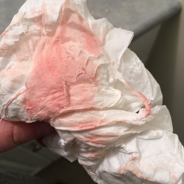 Light pink discharge when i wipe not pregnant ...