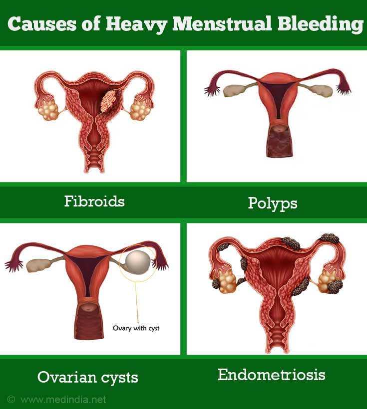Menstrual Periods