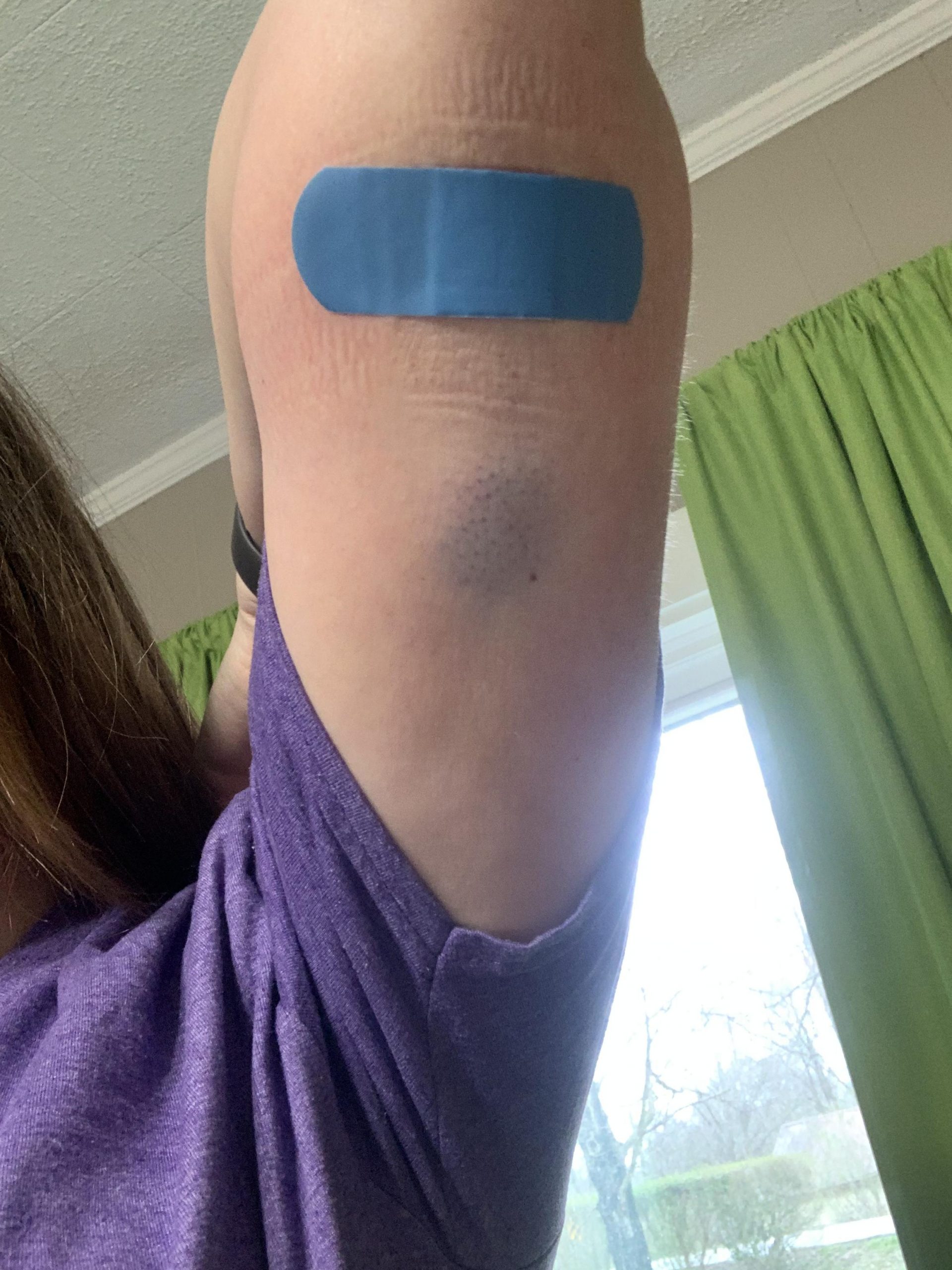Nexplanon Placed On back of arm : birthcontrol