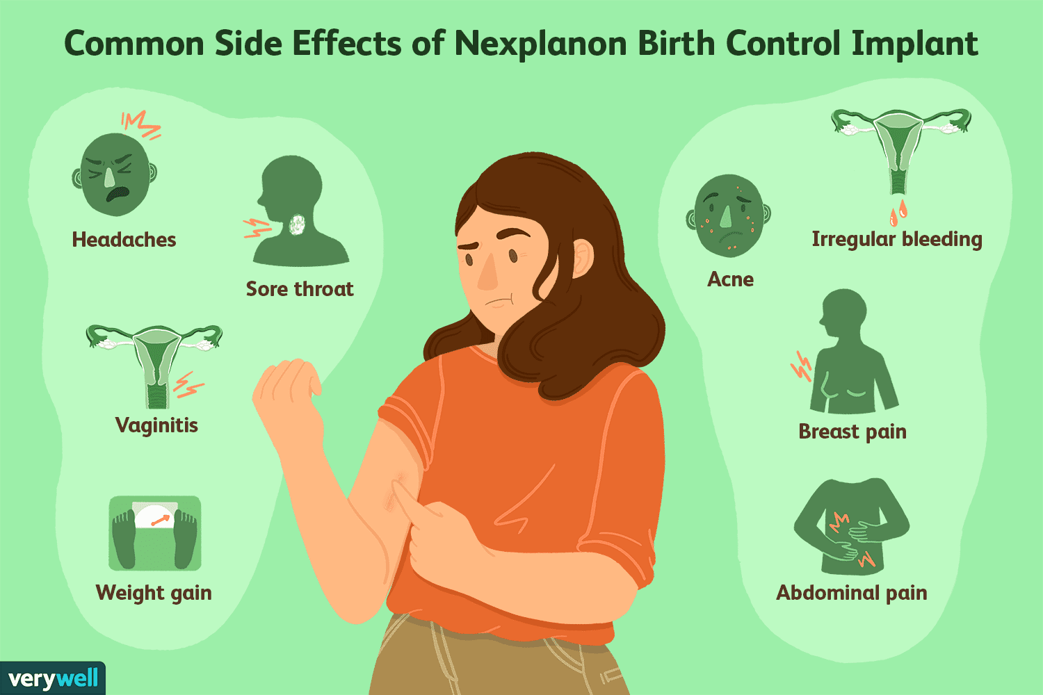 Control term. Nexplanon. Имплантат "Некспланон". Nexplanon имплант противозачаточный.