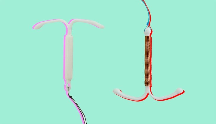 no period after iud removal iammrfoster com