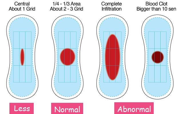 Period Blood Clots: Are They Normal And What Do They Mean?