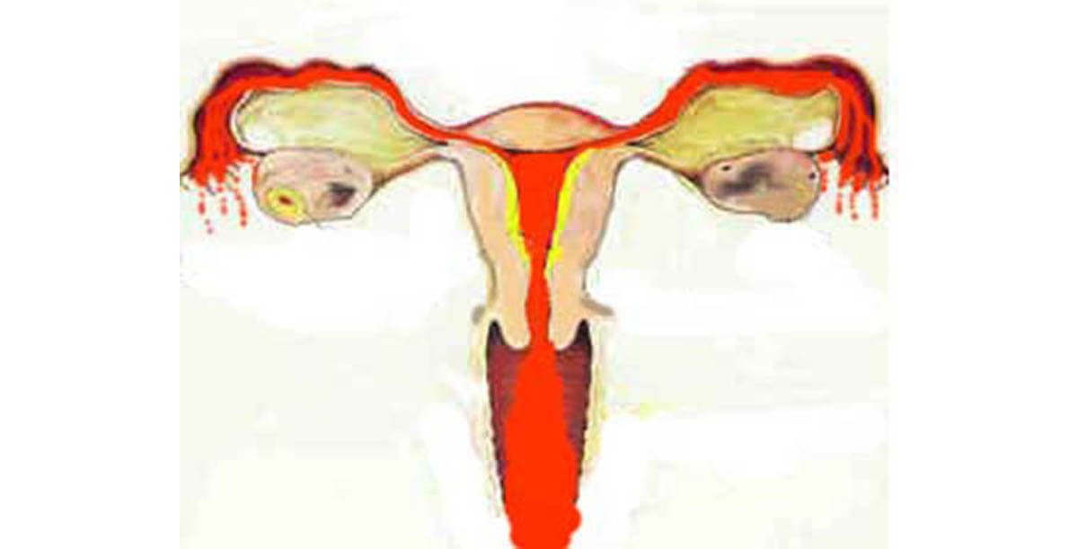 Signs And Symptoms Of Menstruation