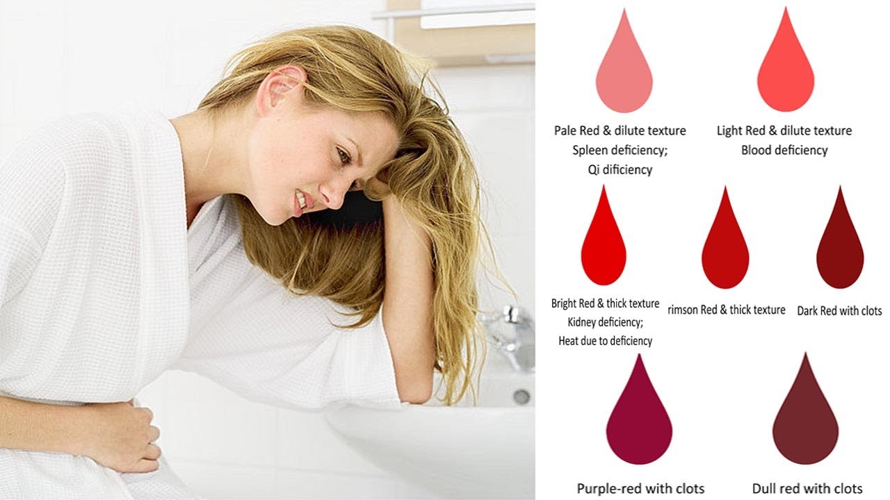 The Colour of Your Period Blood Says About Your Health, Watch Now If ...
