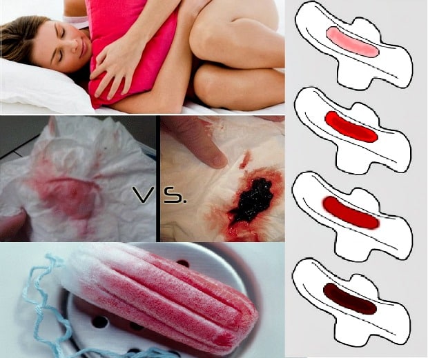 What Does Menstrual Blood Color Say About Your Health?