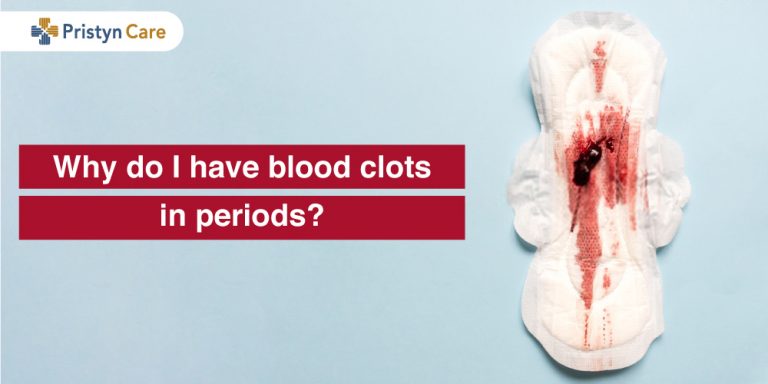 Why do I have blood clots in periods?