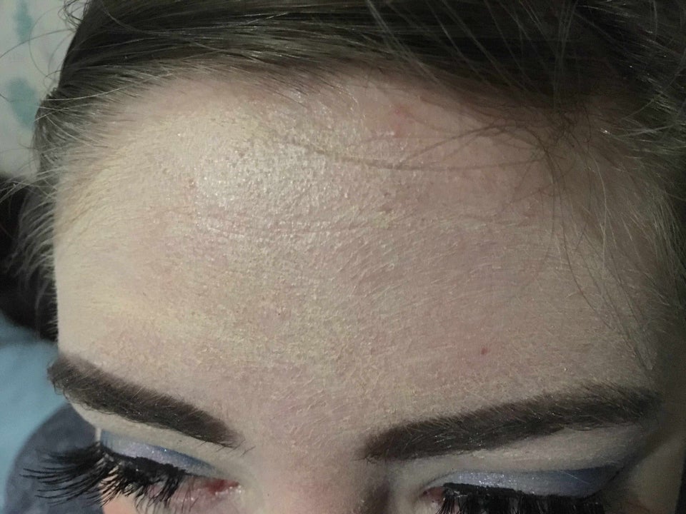 Why does my makeup keep clogging on my forehead like this ...