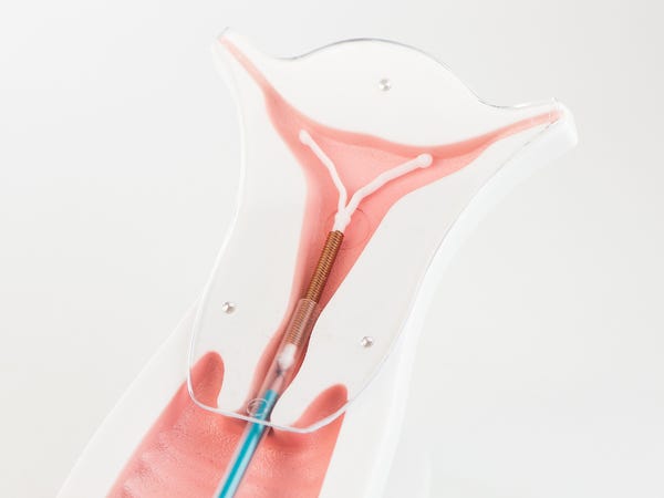 Why you should get your IUD inserted while you